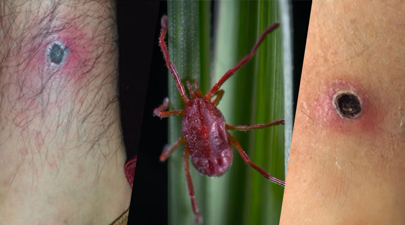 Presentan hallazgos clave sobre el tifus de los...<span class="font-thin text-xs"> [Leer más]</span>